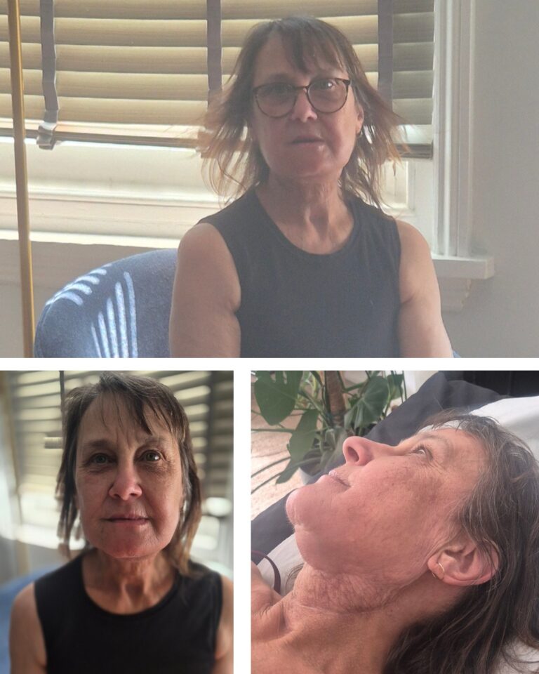 Instagram post from mouthcancer. This post is in position 1.